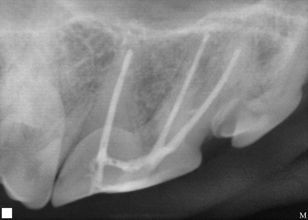 radiograph of pulp tissue