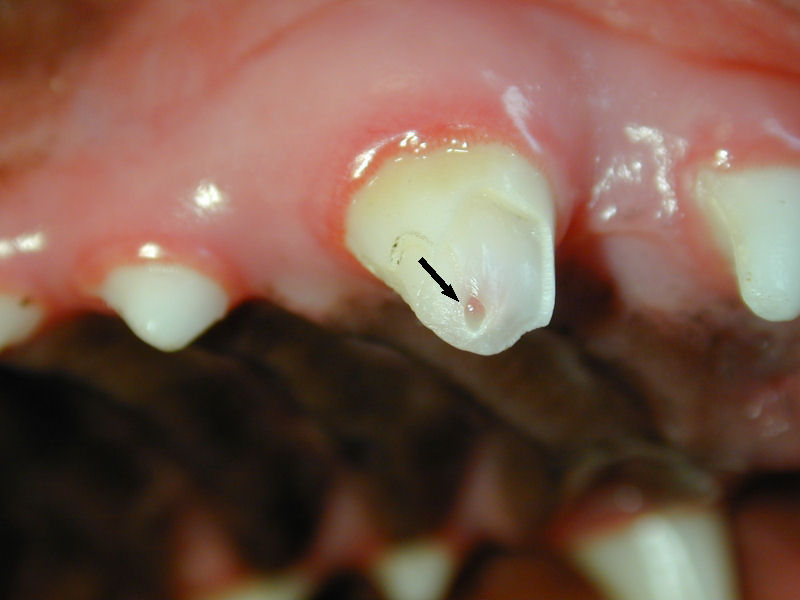 right upper canine tooth