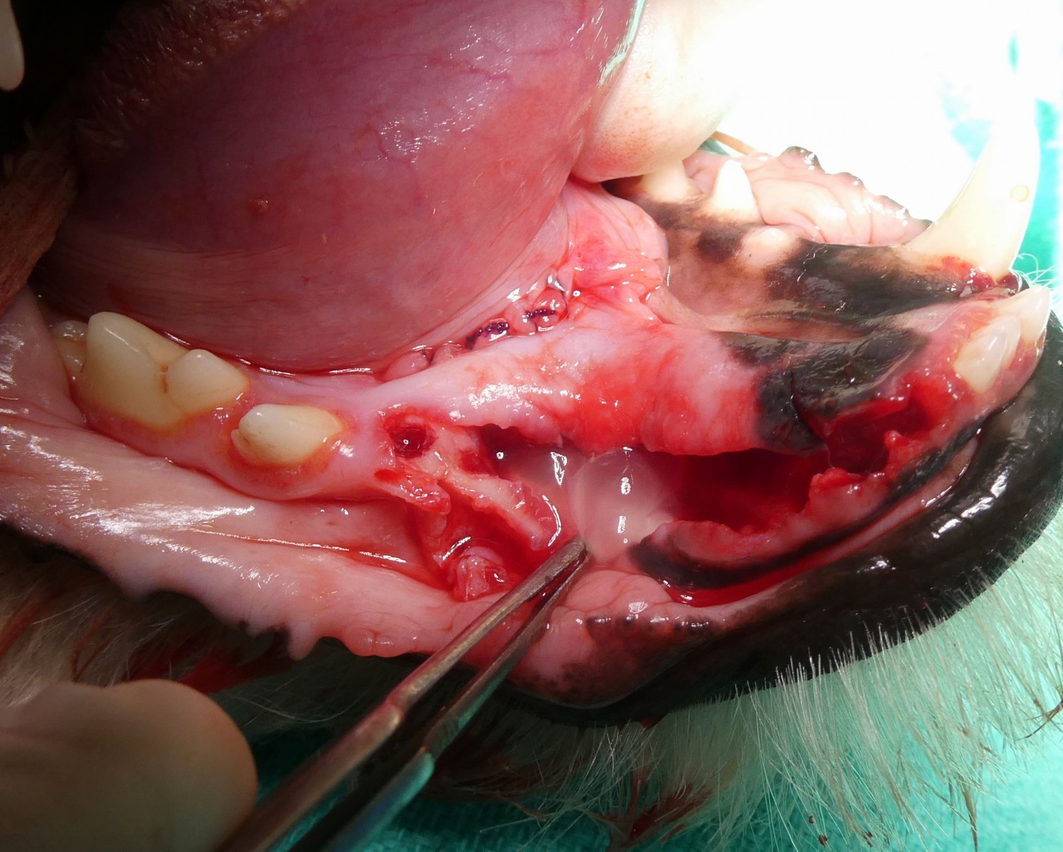 Odontogenic cyst