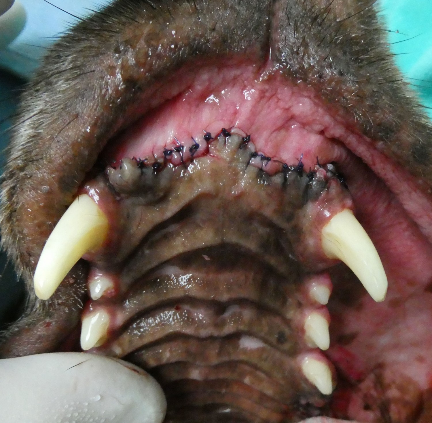 after oral mass removal