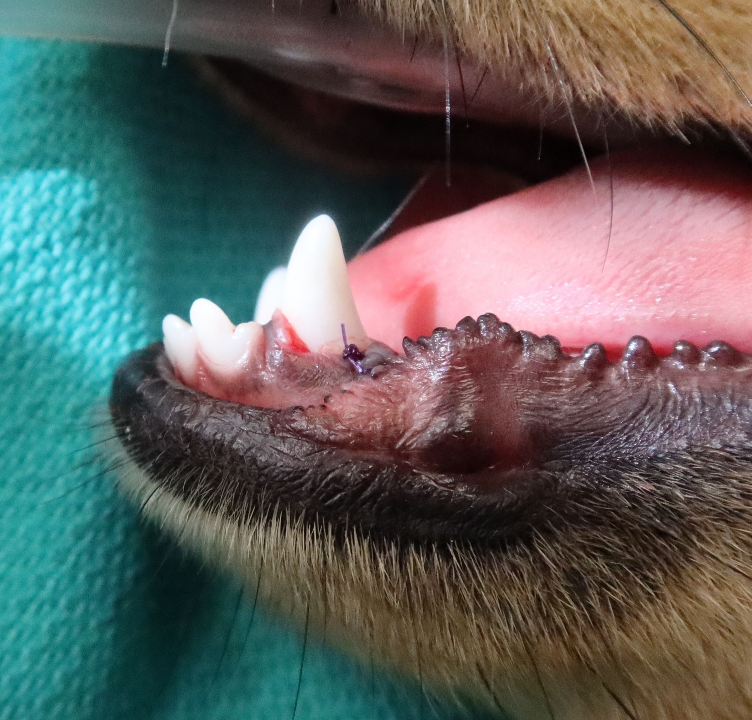 After removal of retained deciduous teeth