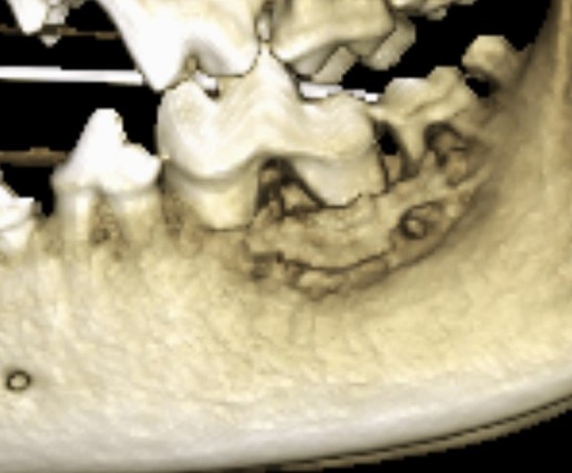 Dental BLOG 7 IMAGE